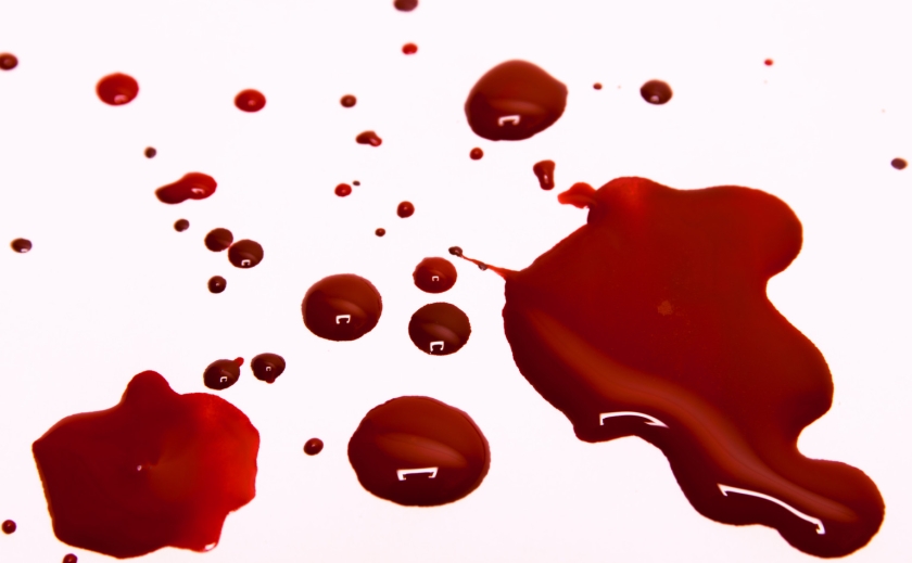 На Дніпропетровщині чоловіка знайшли у калюжі крові
